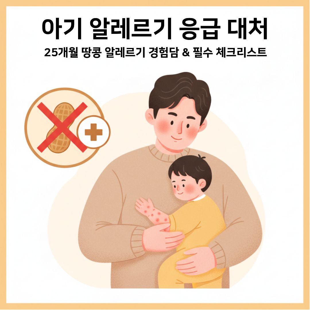 아기 알레르기 응급대처 방법, 25개월 땅콩 알레르기를 직접 겪으며 배운 기록